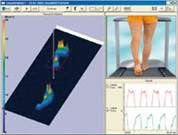 Foot Pressure Pattern